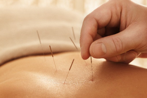 Acupuncture training institute in chennai